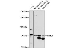 Western blot analysis of extracts of various cell lines, using KLHL8 antibody (ABIN7268081) at 1:1000 dilution. (KLHL8 Antikörper  (AA 271-620))