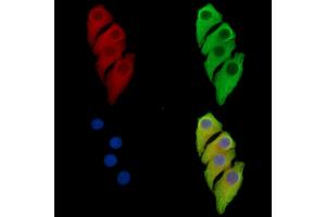 ABIN7097157 and ABIN7101225 staining Hela cells by IF/ICC.