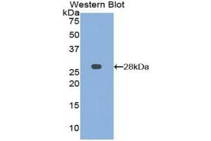 Western blot analysis of the recombinant protein. (MMP15 Antikörper  (AA 336-539))