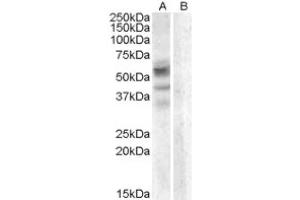 Image no. 1 for anti-Arylsulfatase D (ARSD) (Internal Region) antibody (ABIN374947) (Arylsulfatase D Antikörper  (Internal Region))