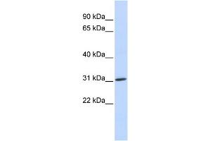 WB Suggested Anti-ARD1A Antibody Titration:  0. (NAA10 Antikörper  (Middle Region))