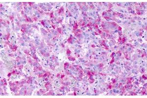Anti-GPR139 antibody IHC staining of human adrenal medulla. (GPR139 Antikörper  (Cytoplasmic Domain))