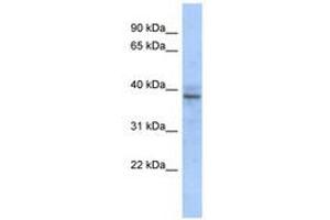 ZNF625 Antikörper  (AA 67-116)
