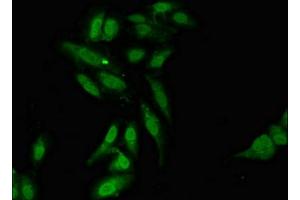 Immunofluorescent analysis of Hela cells using ABIN7158006 at dilution of 1:100 and Alexa Fluor 488-congugated AffiniPure Goat Anti-Rabbit IgG(H+L) (L3MBTL2 Antikörper  (AA 1-230))
