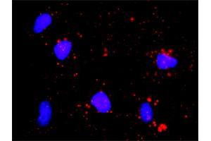 Proximity Ligation Assay (PLA) image for anti-E2F Transcription Factor 1 (E2F1) (AA 348-437) antibody (ABIN560676)