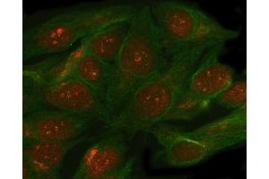 IF analysis of SMC5 using anti-SMC5 antibody (ABIN7600007) and anti-Beta Tubulin antibody (ABIN7602743).