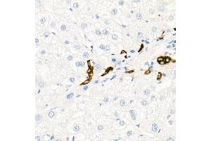 Immunohistochemistry of paraffin-embedded Human liver (negative control sample) using Cytokeratin 19 (KRT19) antibody (ABIN7268099) at dilution of 1:100 (40x lens). (Cytokeratin 19 Antikörper)