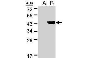 WB Image Western Blot analysis of DHDH expression in transfected 293T cell line by DHDH polyclonal antibody. (AKR1C1 Antikörper)