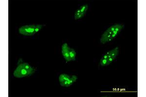 Immunofluorescence of monoclonal antibody to THAP1 on HeLa cell. (THAP1 Antikörper  (AA 1-213))