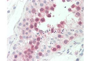 Anti-MPS1 / TTK antibody IHC staining of human testis. (Mps1 Antikörper  (AA 1-176))