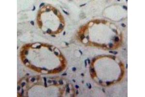Used in DAB staining on fromalin fixed paraffin-embedded Kidney tissue (CD59 Antikörper  (AA 23-105))