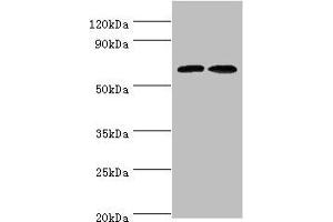 Western blot All lanes: CREB3L2 antibody at 6 μg/mL Lane 1: Mouse liver tissue Lane 2: Mouse lung tissue Secondary Goat polyclonal to rabbit IgG at 1/10000 dilution Predicted band size: 58, 51, 28 kDa Observed band size: 58 kDa (CREB3L2 Antikörper  (AA 1-247))