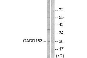 Western blot analysis of extracts from LOVO cells, treated with serum (10%, 15mins), using GADD153 antibody (#C0202). (DDIT3 Antikörper)