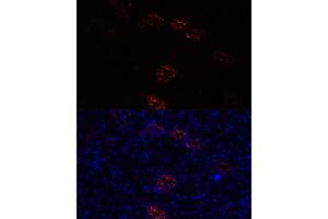 Immunofluorescence analysis of rat kidney cells using  antibody (ABIN7265652) at dilution of 1:100. (AQP2 Antikörper  (AA 147-271))