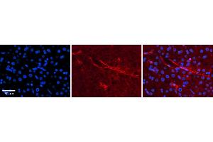 Rabbit Anti-SLC5A5 Antibody  Catalog Number: ARP43751_P050 Formalin Fixed Paraffin Embedded Tissue: Human Adult liver  Observed Staining: Membrane Primary Antibody Concentration: 1:600 Secondary Antibody: Donkey anti-Rabbit-Cy2/3 Secondary Antibody Concentration: 1:200 Magnification: 20X Exposure Time: 0.