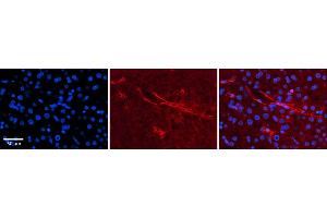 Rabbit Anti-SLC5A5 Antibody  Catalog Number: ARP43751_P050 Formalin Fixed Paraffin Embedded Tissue: Human Adult liver  Observed Staining: Membrane Primary Antibody Concentration: 1:600 Secondary Antibody: Donkey anti-Rabbit-Cy2/3 Secondary Antibody Concentration: 1:200 Magnification: 20X Exposure Time: 0. (SLC5A5 Antikörper  (N-Term))