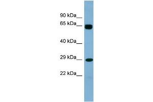 WB Suggested Anti-LRRN4CL Antibody Titration: 0. (LRRN4CL Antikörper  (Middle Region))