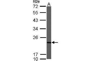 Western Blotting (WB) image for anti-NADH Dehydrogenase (Ubiquinone) 1 beta Subcomplex, 9, 22kDa (NDUFB9) (Center) antibody (ABIN2856130)