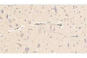 Detection of AHSG in Bovine Cerebellum Tissue using Polyclonal Antibody to Alpha-2-Heremans Schmid Glycoprotein (AHSG) (Fetuin A Antikörper  (AA 19-359))