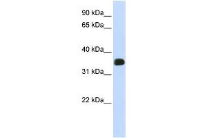 WB Suggested Anti-C2orf47 Antibody Titration:  0. (C2orf47 Antikörper  (Middle Region))