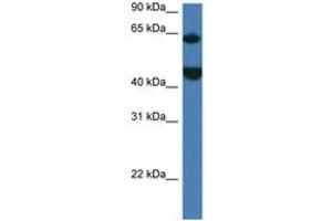 Image no. 1 for anti-Lysophosphatidylcholine Acyltransferase 2 (LPCAT2) (AA 167-216) antibody (ABIN6747272) (LPCAT2 Antikörper  (AA 167-216))