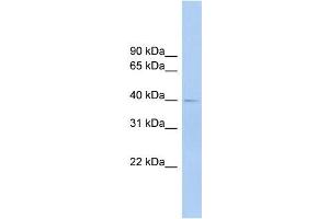 Human Lung; WB Suggested Anti-FCRLA Antibody Titration: 0.
