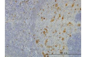 Immunostaining (ISt) image for anti-Aldo-Keto Reductase Family 1, Member A1 (Aldehyde Reductase) (AKR1A1) (AA 1-325) antibody (ABIN564487)
