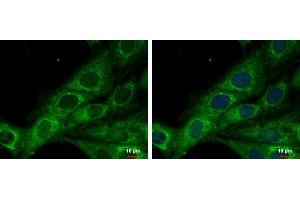 ICC/IF Image COX6A2 antibody [N3C3] detects COX6A2 protein at mitochondria by immunofluorescent analysis.