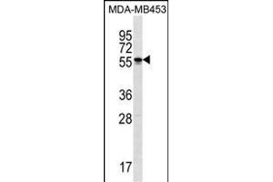 SOHLH2 Antibody (Center) (ABIN1538138 and ABIN2849993) western blot analysis in MDA-M cell line lysates (35 μg/lane). (SOHLH2 Antikörper  (AA 232-258))