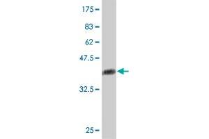 Western Blotting (WB) image for anti-Integrin, alpha E (Antigen CD103, Human Mucosal Lymphocyte Antigen 1, alpha Polypeptide) (ITGAE) (AA 57-171) antibody (ABIN561548)