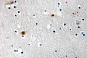 Immunohistochemistry (IHC) analyzes of TAF I p48 antibody in paraffin-embedded human brain carcinoma tissue. (SET/TAF-I Antikörper)