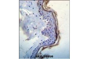 KIT Antibody (N-term ) (ABIN392010 and ABIN2837978) immunohistochemistry analysis in formalin fixed and paraffin embedded human skin tissue followed by peroxidase conjugation of the secondary antibody and DAB staining.
