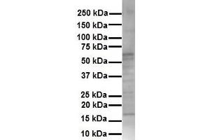 WB Suggested Anti-KRT16 antibody Titration: 1 ug/mL Sample Type: Human HepG2 (KRT16 Antikörper  (Middle Region))