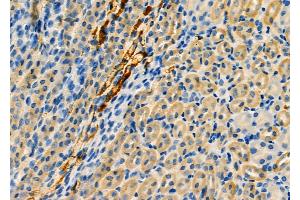 ABIN6259341 and ABIN6275460 at 1/100 staining Mouse kidney tissue by IHC-P.