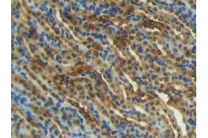 Immunohistochemistry (IHC) image for anti-S100 Calcium Binding Protein A1 (S100A1) (AA 2-94) antibody (ABIN7430387)