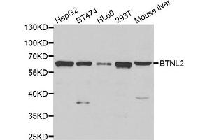 Western blot analysis of extracts of various cell lines, using BTNL2 antibody. (BTNL2 Antikörper)