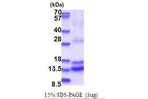 SDS-PAGE (SDS) image for Caspase 2, Apoptosis-Related Cysteine Peptidase (CASP2) (AA 348-452) protein (His tag) (ABIN5853713) (Caspase 2 Protein (AA 348-452) (His tag))