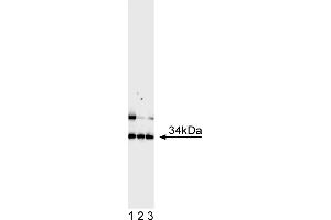 Western Blotting (WB) image for anti-Achaete-Scute Complex Homolog 1 (Drosophila) (ASCL1) antibody (ABIN967560) (ASCL1 Antikörper)
