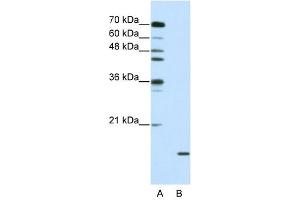 SNRPA1 antibody used at 2. (SNRPA1 Antikörper  (C-Term))
