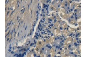 DAB staining on IHC-P; Samples: Mouse Stomach Tissue (TRAPPC10 Antikörper  (AA 1077-1259))