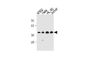 MECR Antibody (Center) (ABIN1881536 and ABIN2843275) western blot analysis in K562,Hela,HL-60,Jurkat cell line lysates (35 μg/lane). (MECR Antikörper  (AA 201-229))