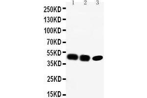 Anti-CCR6 antibody, Western blotting Lane 1: Rat Liver Tissue Lysate Lane 2: SW620 Cell Lysate Lane 3: CEM Cell Lysate (CCR6 Antikörper  (C-Term))