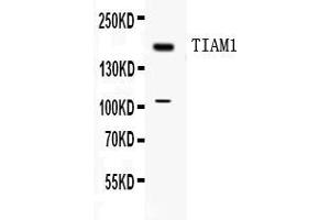 Western blot analysis of TIAM1 expression in MCF-7 whole cell lysates ( Lane 1). (TIAM1 Antikörper  (C-Term))