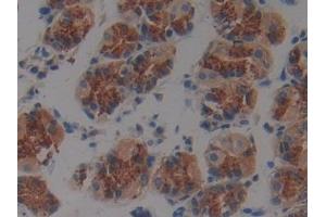 DAB staining on IHC-P; Samples: Human Stomach Tissue (Plakophilin 2 Antikörper  (AA 571-849))