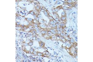 Immunohistochemistry (IHC) image for anti-FYVE, RhoGEF and PH Domain Containing 1 (FGD1) (AA 700-800) antibody (ABIN7267284)