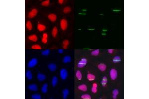 Immunofluorescence analysis of U2OS cells using POLE3 antibody (ABIN5973867). (POLE3 Antikörper)