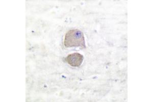 Image no. 1 for anti-BCL2-Associated X Protein (BAX) antibody (ABIN265325) (BAX Antikörper)