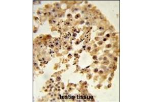 Formalin-fixed and paraffin-embedded human testis tissue reacted with D Antibody (N-term), which was peroxidase-conjugated to the secondary antibody, followed by DAB staining. (DPP8 Antikörper  (N-Term))