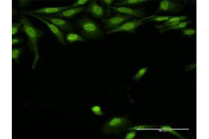Immunofluorescence of purified MaxPab antibody to TRADD on HeLa cell. (TRADD Antikörper  (AA 1-312))