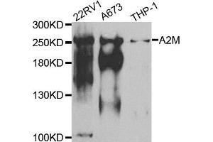Western blot analysis of extracts of various cell lines, using A2M antibody. (alpha 2 Macroglobulin Antikörper  (AA 1155-1474))